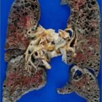 “EL COMAL LE DIJO A LA OLLA”